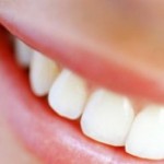 Pulizia dei denti: quando farla?