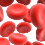 Anemia: cause,sintomi e rimedi