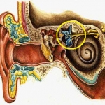 Sindrome di Meniere: cos’è?