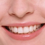 Sbiancamento dei denti: tutto quello che c’è da sapere